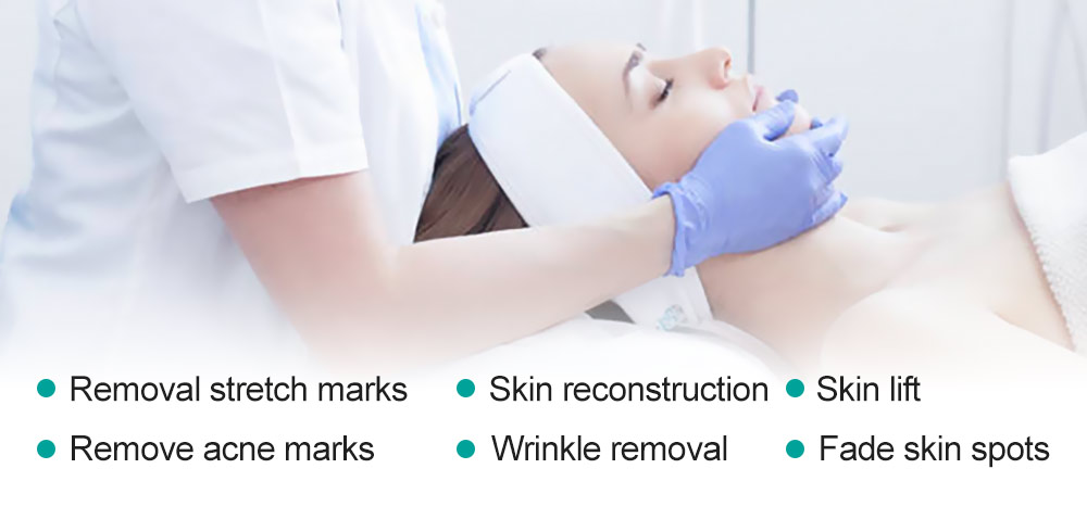 V-Nice gold micro-needles make troubles no longer 