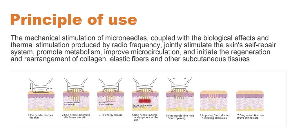 Dermashine-4 Principle introduction