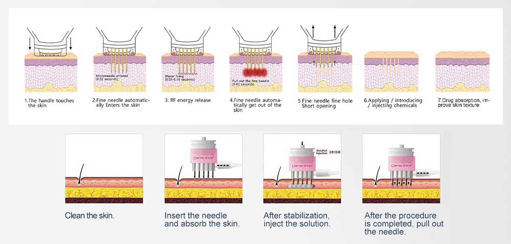 Dermashine 4 Technology Brief