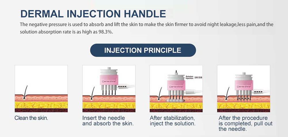 DerMashine IV tightens skin