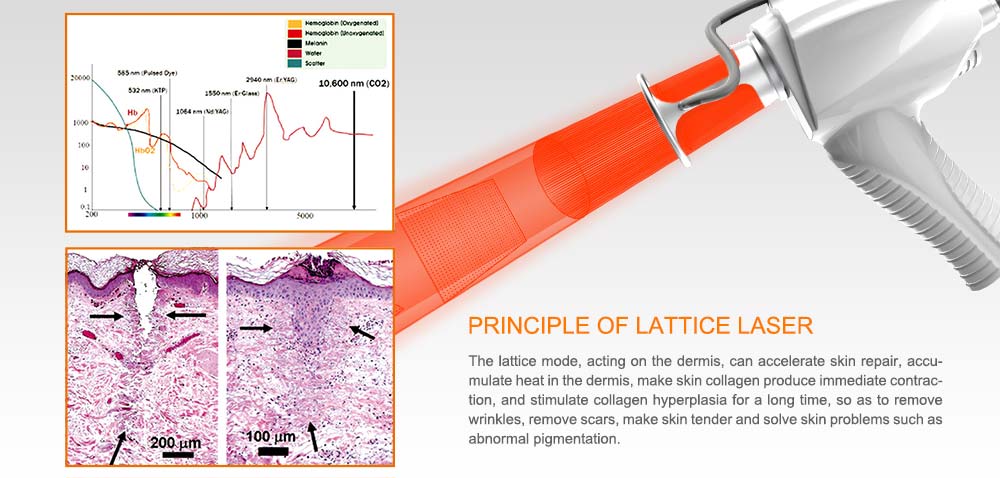Instrument name: CO2 lattice laser
