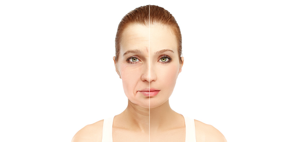 What is Intense Pulsed Light (IPL)