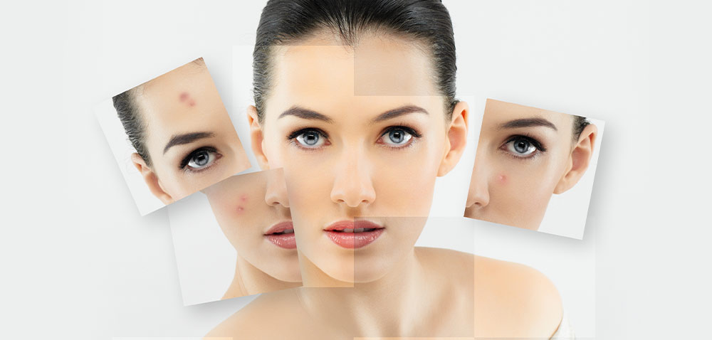 What are the advantages of DPL exquisite skin rejuvenation beauty instrument