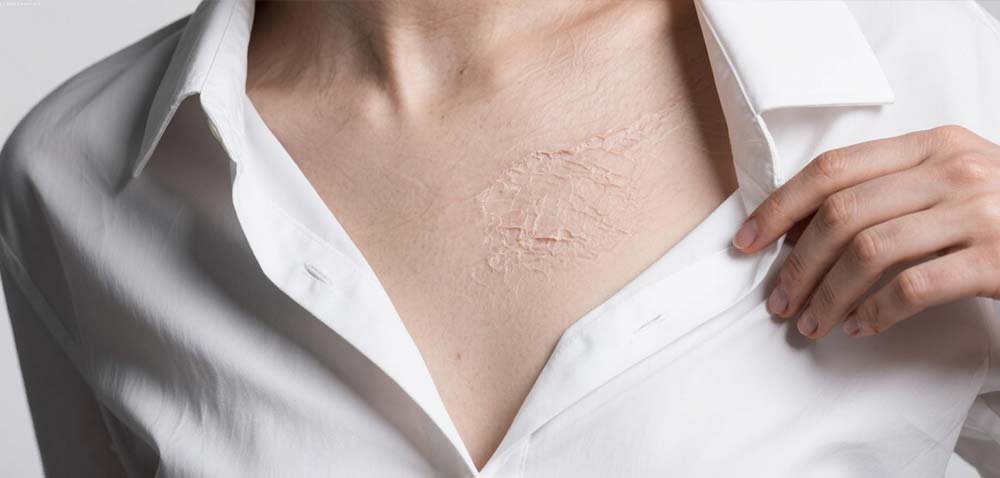 Introduction to Laser Surgery