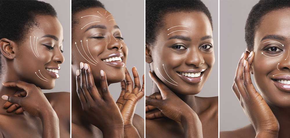 V-NICE gold RF microneedle