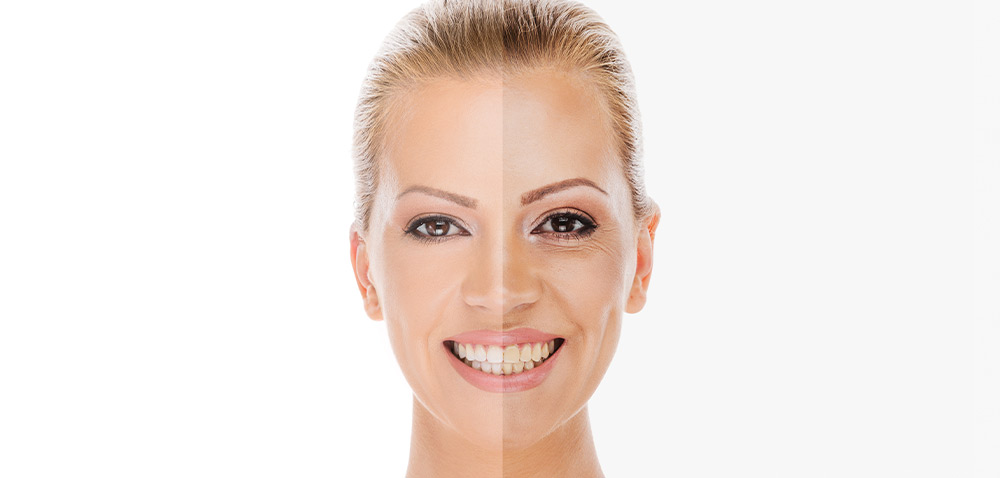 What are the advantages of ultrasound anti-aging?