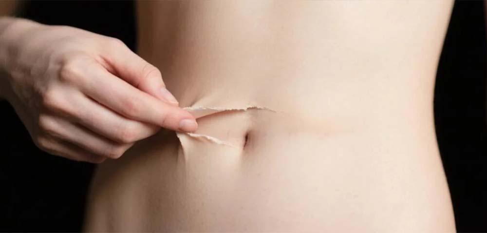 DPL precision skin rejuvenation instrument