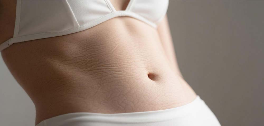 What is HIFU Machines？