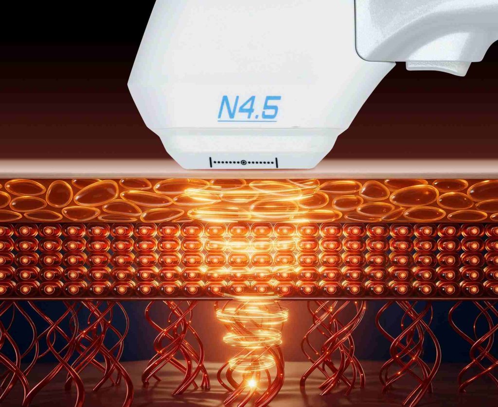 HIFU Technology